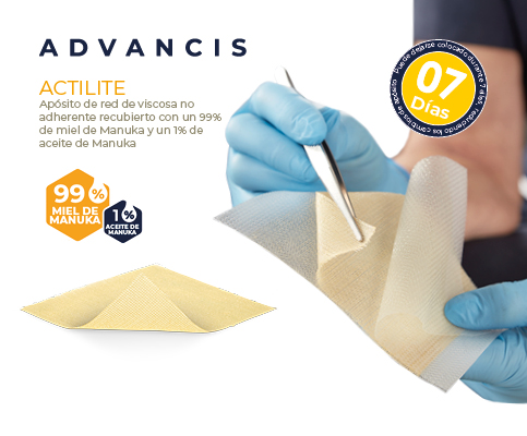 actilite Actilite