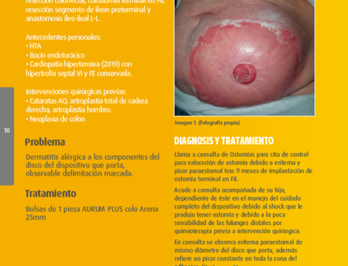 Dermatitis alérgica a componentes del dispositivo