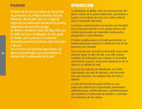 Cuidados de enfermería en dermatitis y úlceras periestomales del paciente con ileostomía